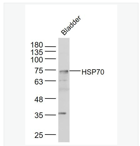 Anti-HSP70 antibody-热休克蛋白-70抗体,HSP70