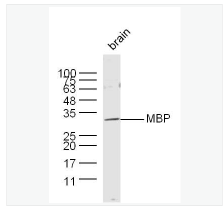 Anti-MBP antibody -髓鞘碱性蛋白/磷脂碱性蛋白抗体,MBP