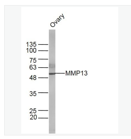 Anti-MMP13 antibody-基质金属蛋白酶13抗体,MMP13