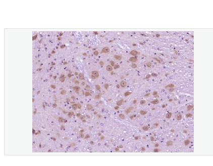 Anti-Neurocan antibody-神经粘蛋白抗体,Neurocan