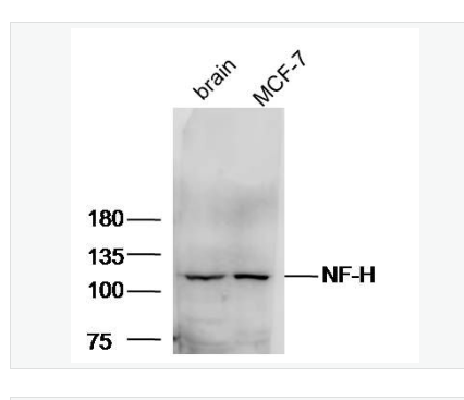 Anti-NF-H antibody-高分子量神经丝蛋白抗体,NF-H