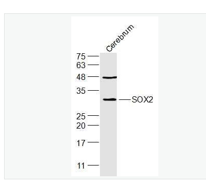 Anti-SOX2 antibody-胚胎干细胞关键蛋白抗体,SOX2