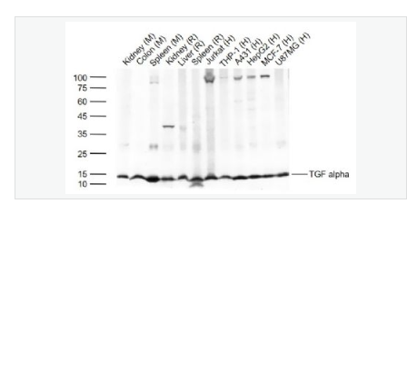 Anti-TGF alpha antibody-轉(zhuǎn)移生長(zhǎng)因子α抗體,TGF alpha