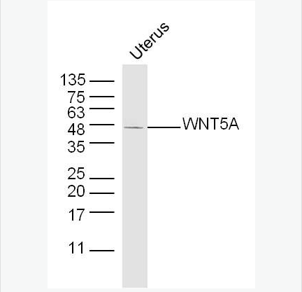 Anti-WNT5A antibody-信號(hào)通路Wnt5a抗體,WNT5A