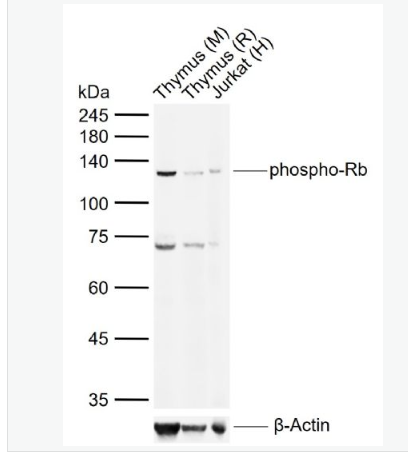Anti-phospho-Rb (Ser780) antibody-磷酸化成视网膜细胞瘤抑癌蛋白抗体,phospho-Rb (Ser780)