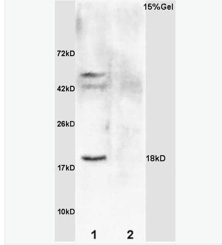 Anti-GADD45A antibody-生长抑制DNA损伤基因45抗体,GADD45A