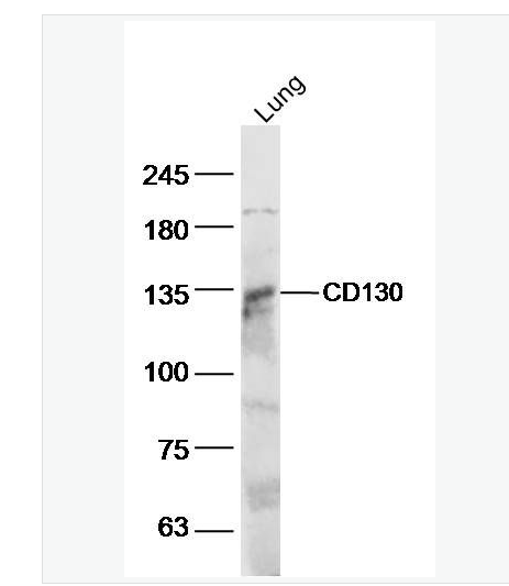 Anti-IL6ST/CD130 antibody-白细胞介素6受体β/CD130抗体,IL6ST/CD130