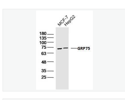 Anti-GRP75 antibody-G蛋白偶联受体75抗体,GRP75
