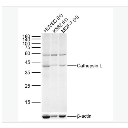 Anti-Cathepsin L antibody-组织蛋白酶L抗体,Cathepsin L