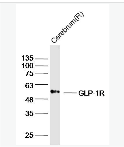 Anti-GLP-1R antibody-胰高血糖素样肽-1受体/GLP-1受体抗体,GLP-1R