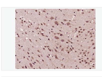 Anti-GSK-3 Beta antibody-糖原合酶激酶-3β抗體,GSK-3 Beta