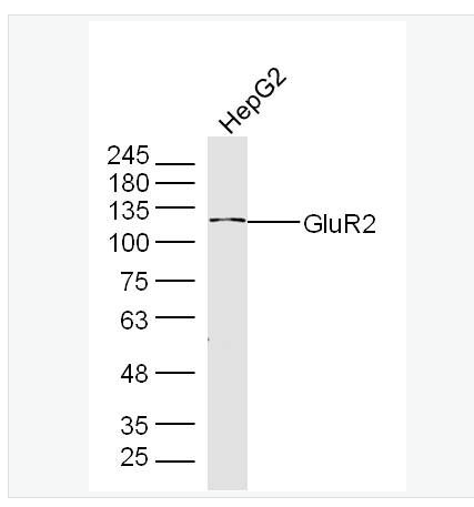 Anti-GLUR2 antibody-谷氨酸受体2抗体,GLUR2