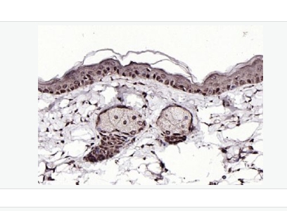 Anti-SPDEF antibody-上皮特异性ETs转录因子抗体,SPDEF