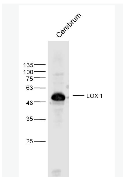 Anti-LOX 1 antibody-凝集素樣氧化型低密度脂蛋白受體抗體,LOX 1