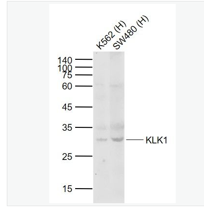 Anti-KLK1 antibody-激肽释放酶1抗体,KLK1