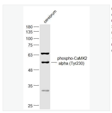 Anti-phospho-CaMK2 alpha (Tyr230) antibody-磷酸化鈣/鈣調(diào)素依賴蛋白激酶2α抗體,phospho-CaMK2 alpha (Tyr230)