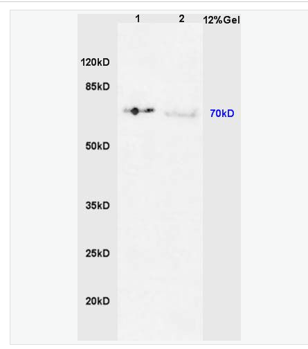 Anti-Phospho-IRAK1 (Thr387) antibody-磷酸化白介素-1受體相關(guān)激酶1抗體,Phospho-IRAK1 (Thr387)