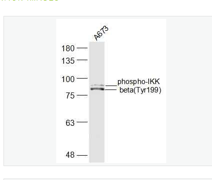 Anti-phospho-IKK beta (Tyr199) antibody-磷酸化KB抑制蛋白激酶β抗体,phospho-IKK beta (Tyr199)