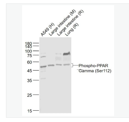 Anti-Phospho-PPAR Gamma (Ser112) antibody-磷酸化過(guò)氧化酶活化增生受體γ抗體,Phospho-PPAR Gamma (Ser112)