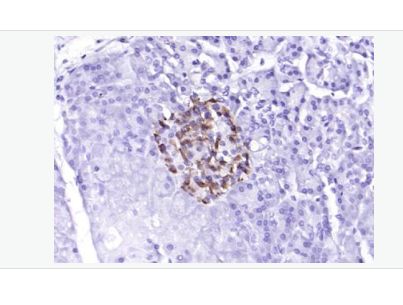 Anti-Phospho-PERK (Thr980) antibody-磷酸化蛋白激酶樣內(nèi)質(zhì)網(wǎng)激酶抗體,Phospho-PERK (Thr980)