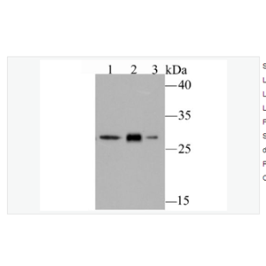 Anti-GCLM  antibody-GCLM重组兔单克隆抗体