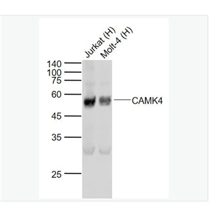 Anti-CAMK4   antibody-钙/钙调蛋白依赖性蛋白激酶4重组兔单克隆抗体