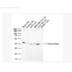 Anti-Tissue factor  antibody-组织因子（CD142）兔单克隆抗体