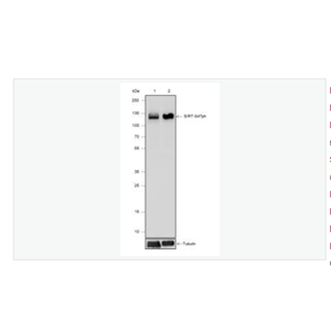 Anti-Phospho-SIRT1  antibody-磷酸化沉默调节蛋白1重组兔单克隆抗体