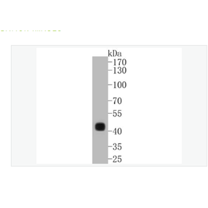 Anti-CDX2  antibody-尾型同源盒转录因子2重组兔单克隆抗体