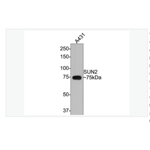 Anti-SUN2antibody-SUN2重组兔单克隆抗体