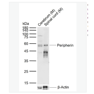 Anti-Peripherin antibody-外周蛋白抗体