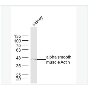 Anti-alpha smooth muscle Actin  antibody-肌动蛋白α/α-SMA/α Actin抗体,alpha smooth muscle Actin