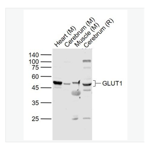 Anti-GLUT1  antibody-葡萄糖转运蛋白1抗体