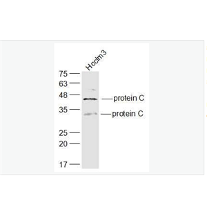 Anti-protein C  antibody-维生素K依赖的蛋白C重链抗体