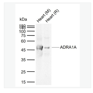 Anti-ADRA1A  antibody-alpha 1肾上腺素能受体A抗体,ADRA1A