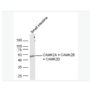 Anti-CAMK2A + CAMK2B + CAMK2Dantibody-钙/钙调素依赖蛋白激酶2b/2γ抗体