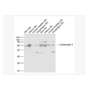 Anti-Cytokeratin 5  antibody-细胞角蛋白5抗体