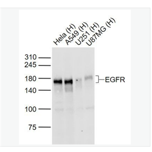 Anti-EGFR antibody-表皮生长因子受体抗体