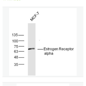 Anti-Estrogen Receptor alpha antibody-雌激素受体α抗体