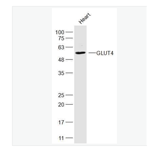 Anti-GLUT4 antibody-葡萄糖转运蛋白4抗体,GLUT4