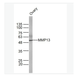 Anti-MMP13 antibody-基质金属蛋白酶13抗体