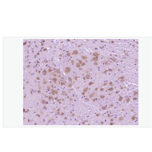 Anti-Neurocan antibody-神经粘蛋白抗体