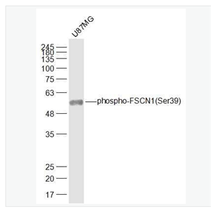 Anti-phospho-FSCN1 (Ser39) antibody-磷酸化纤维束蛋白同源物1抗体