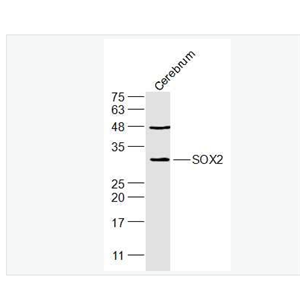 Anti-SOX2 antibody-胚胎干细胞关键蛋白抗体