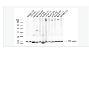 Anti-TGF alpha antibody-转移生长因子α抗体