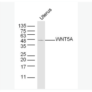 Anti-WNT5A antibody-信号通路Wnt5a抗体