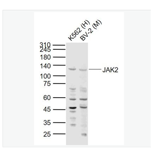 Anti-JAK2 antibody-蛋白质酪氨酸激酶JAK2抗体,JAK2