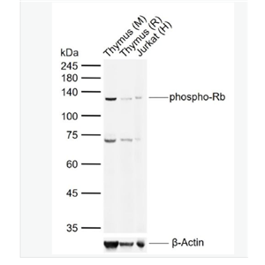 Anti-phospho-Rb (Ser780) antibody-磷酸化成视网膜细胞瘤抑癌蛋白抗体