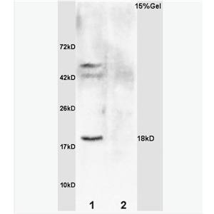 Anti-GADD45A antibody-生长抑制DNA损伤基因45抗体