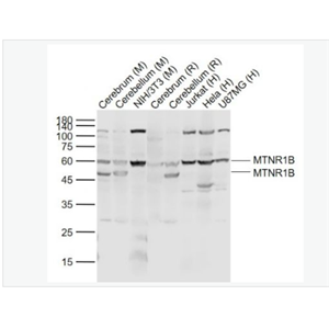 Anti-MTNR1B antibody-褪黑素受体1B抗体,MTNR1B